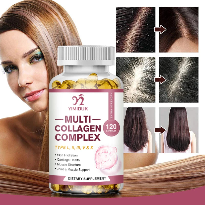 All-in-One Multi Collagen Complex Capsules, with Vitamin A, for Skin Hydration, Promote Joint Flexibility, Hair, Women & Men
